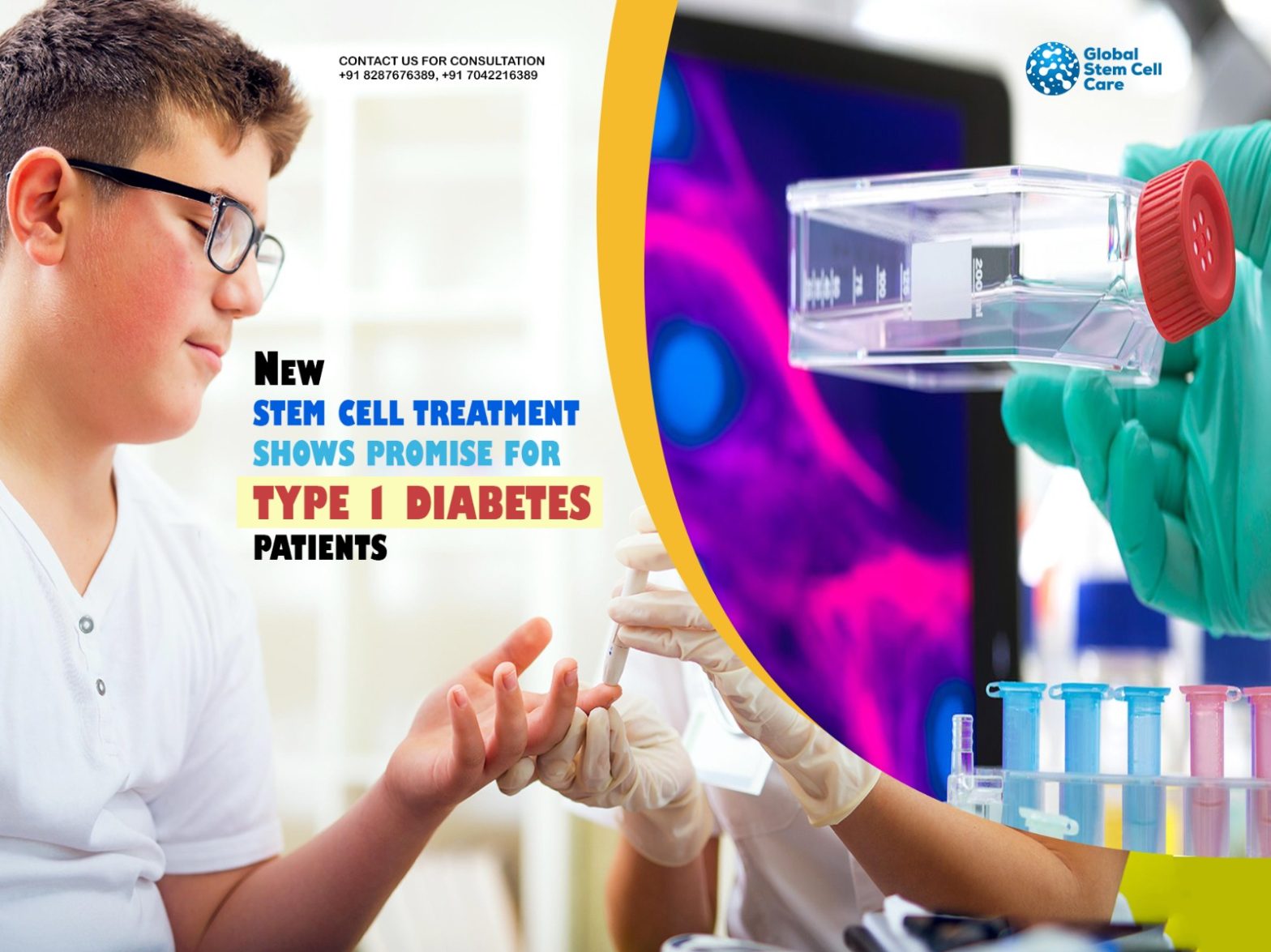 New Stem Cell Treatment Shows Promise for Type 1 Diabetes Patients