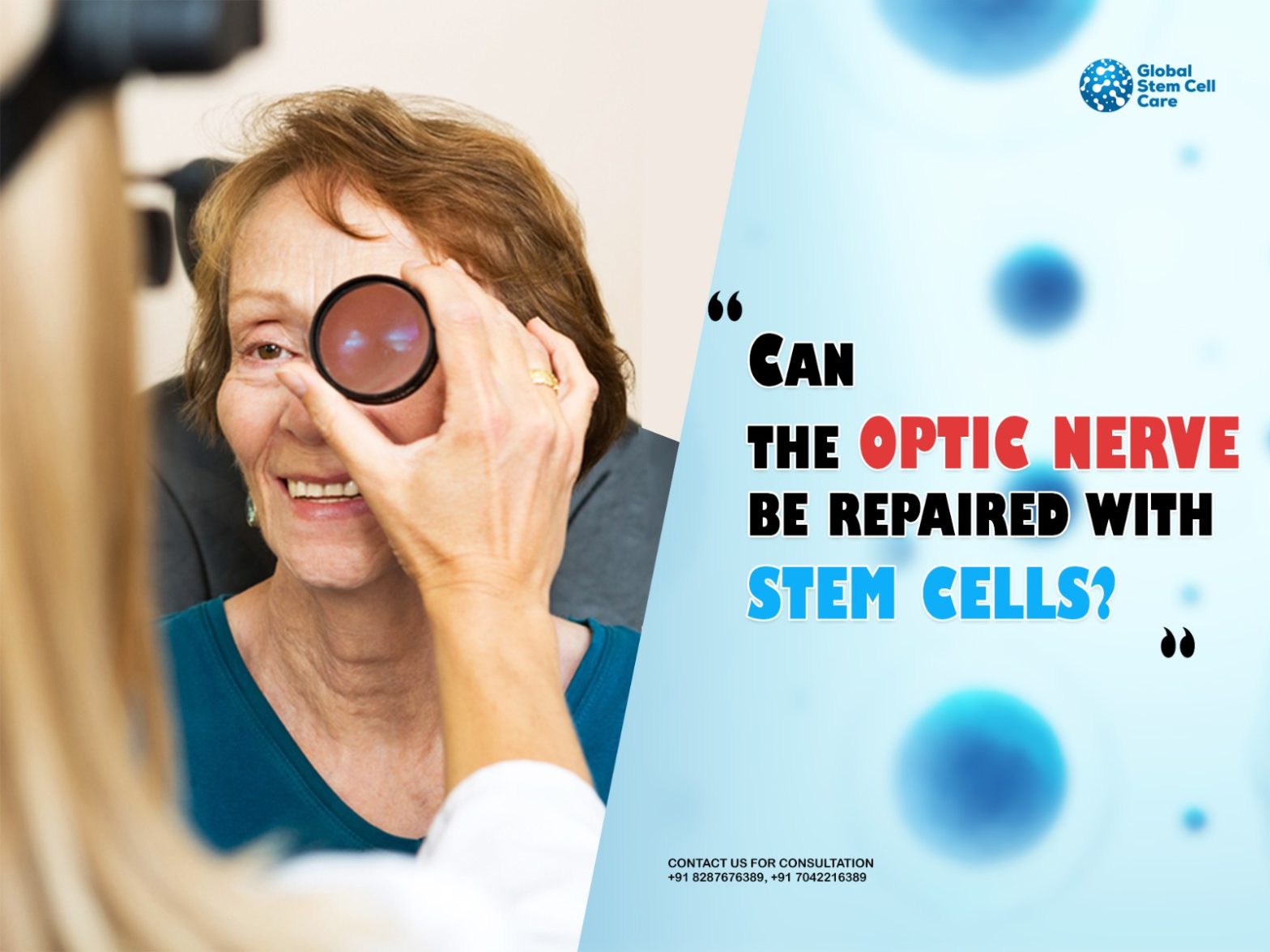 Can the Optic Nerve Be Repaired With Stem Cells?