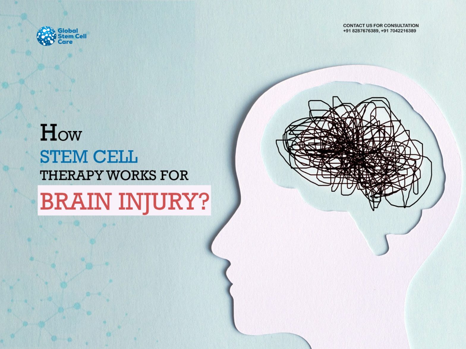 How Stem Cell Therapy Works for Brain Injury?