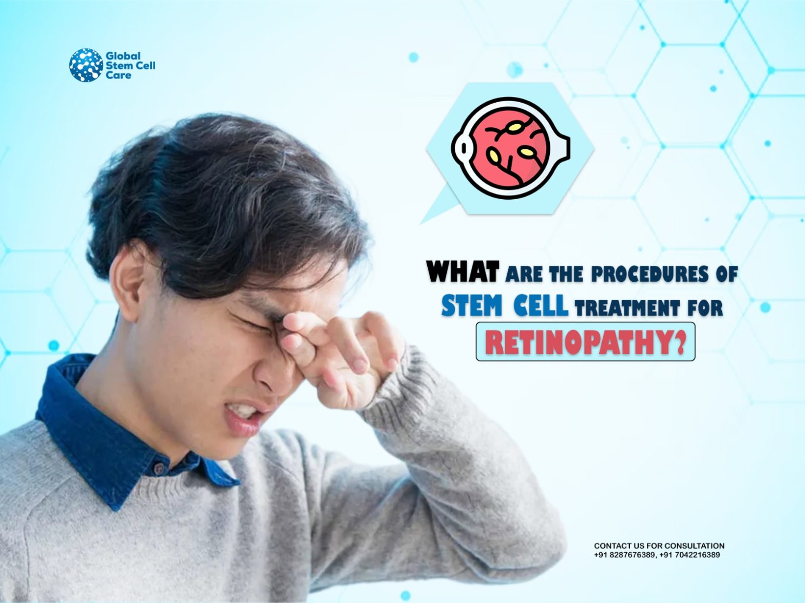 What Are the Procedures of Stem Cell Treatment for Retinopathy?