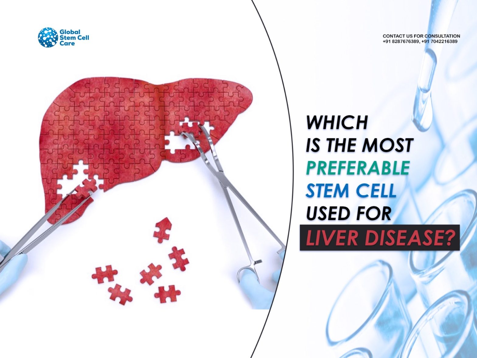 Which Is The Most Preferable Stem Cell Used For Liver Disease?