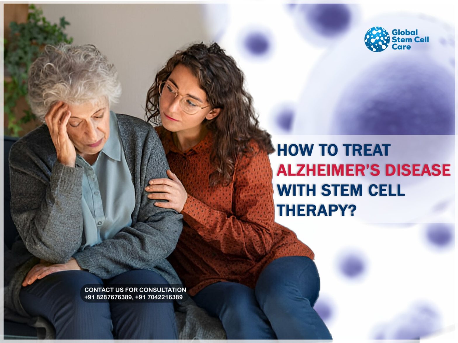 How to Treat Alzheimer’s Disease With Stem Cell Therapy?