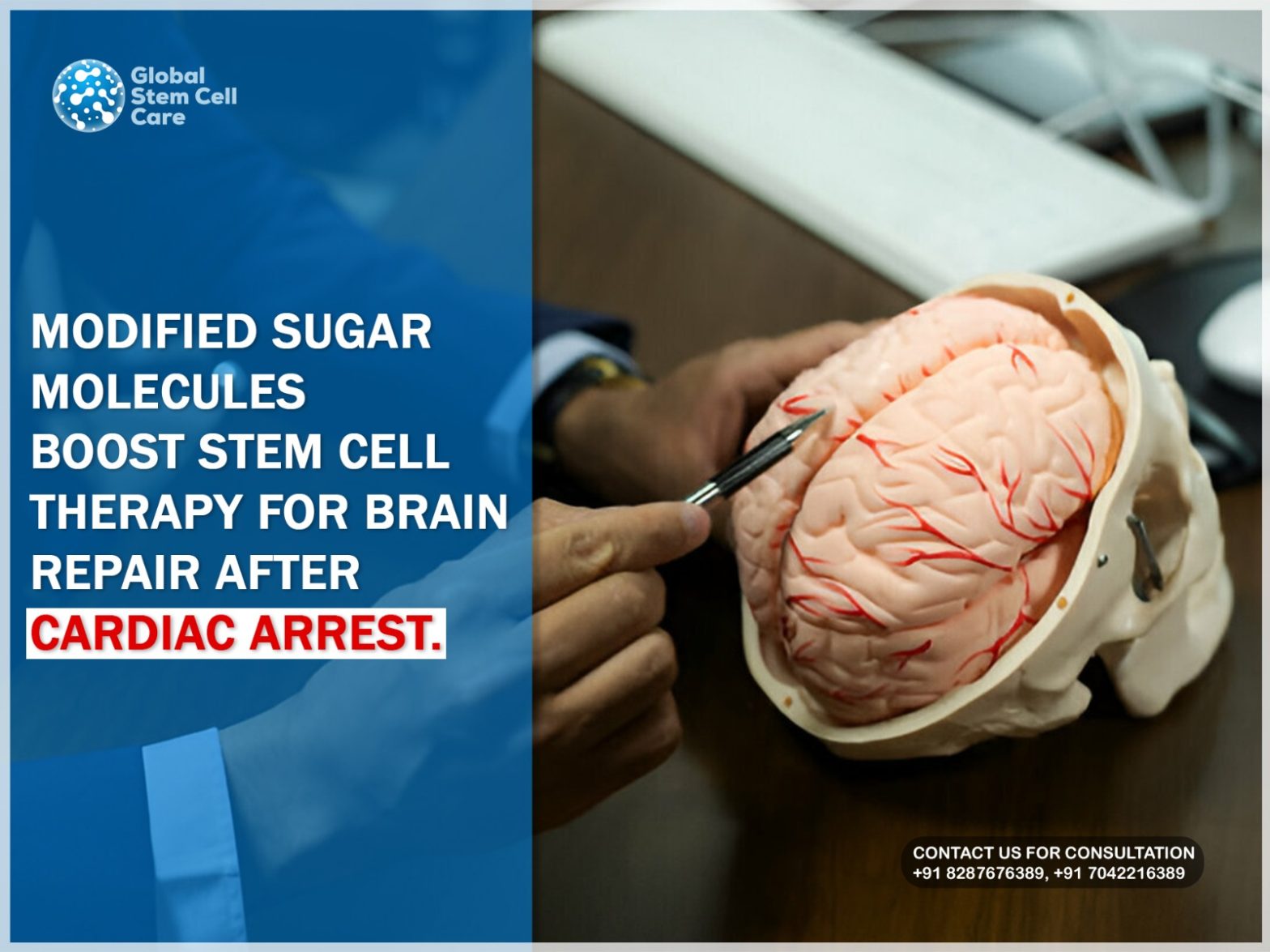 Modified Sugar Molecules Boost Stem Cell Therapy For Brain Repair After Cardiac Arrest.