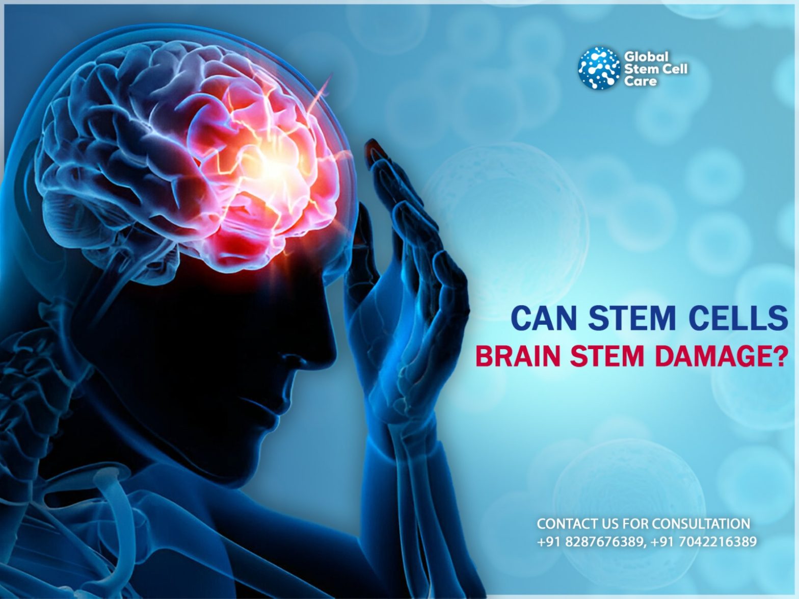 Brain Stem Damage