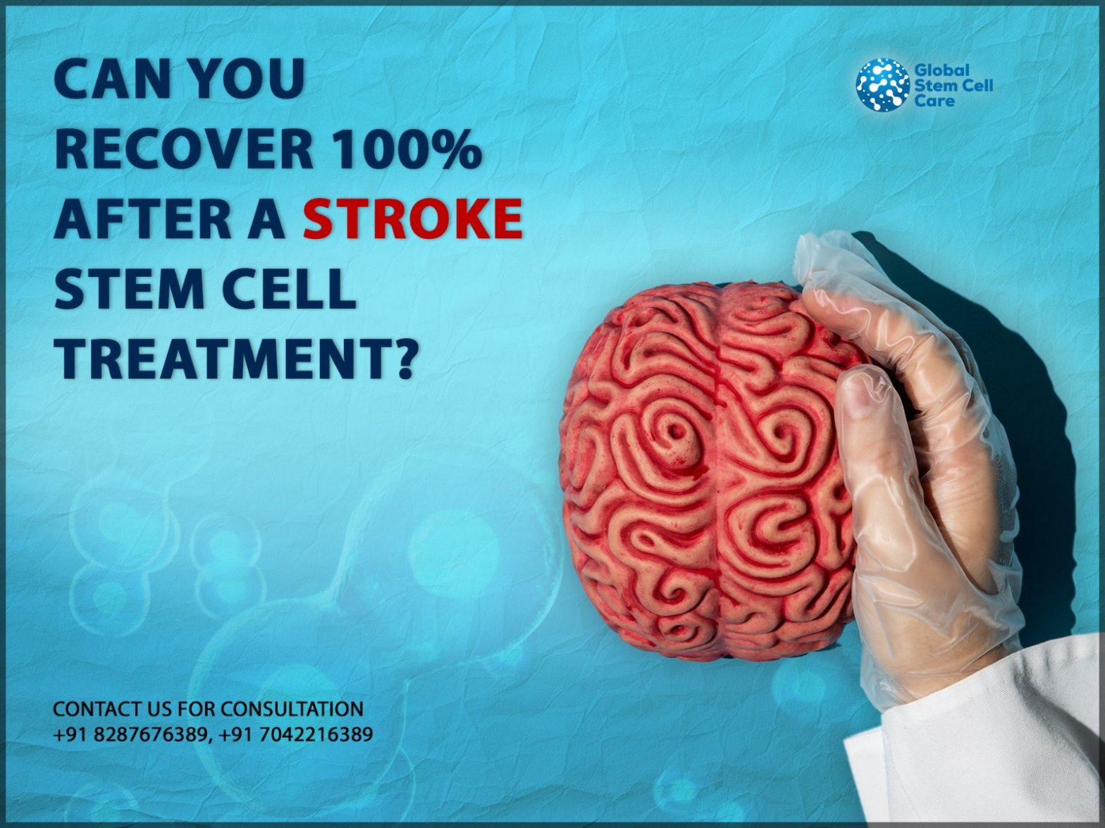 Stroke Stem Cell Treatment