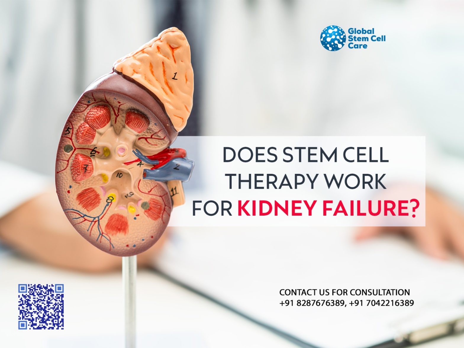 Does Stem Cell Therapy Work for Kidney Failure?