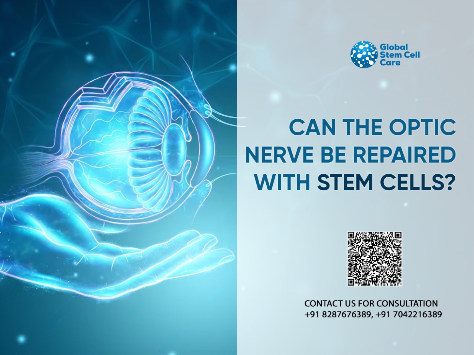 Can the Optic Nerve Be Repaired With Stem Cells?