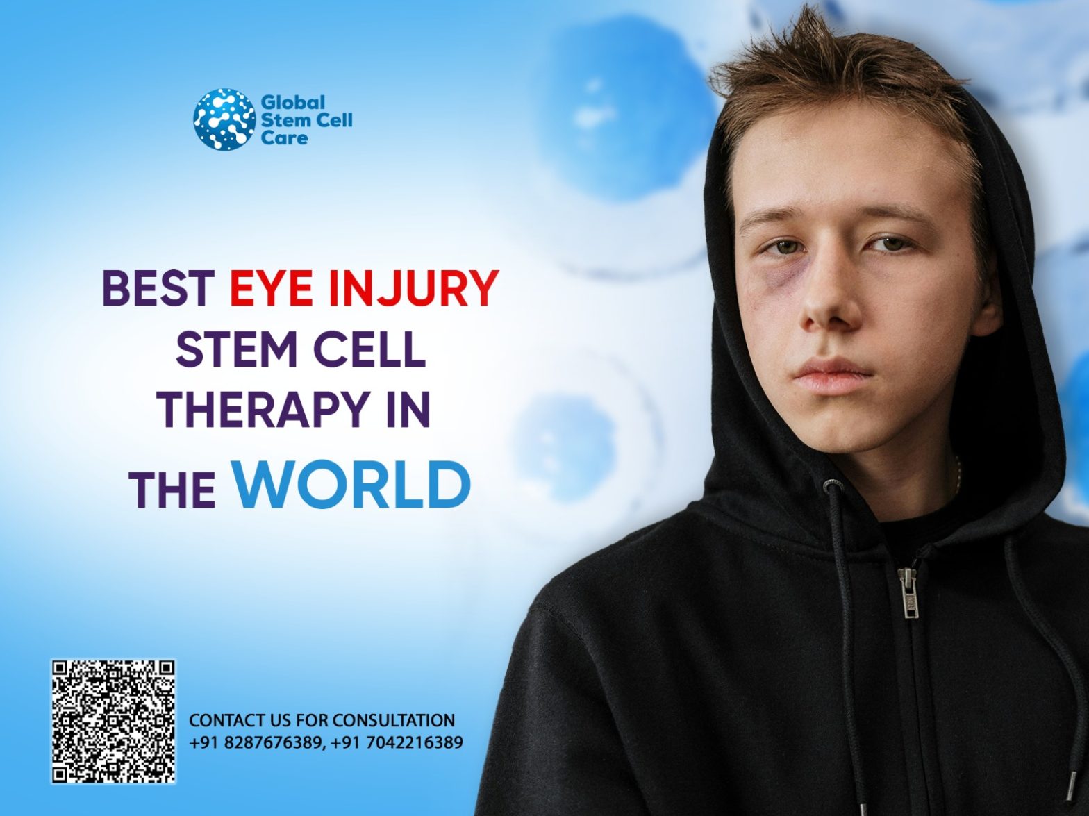 Best Eye Injury Stem Cell Therapy in the World