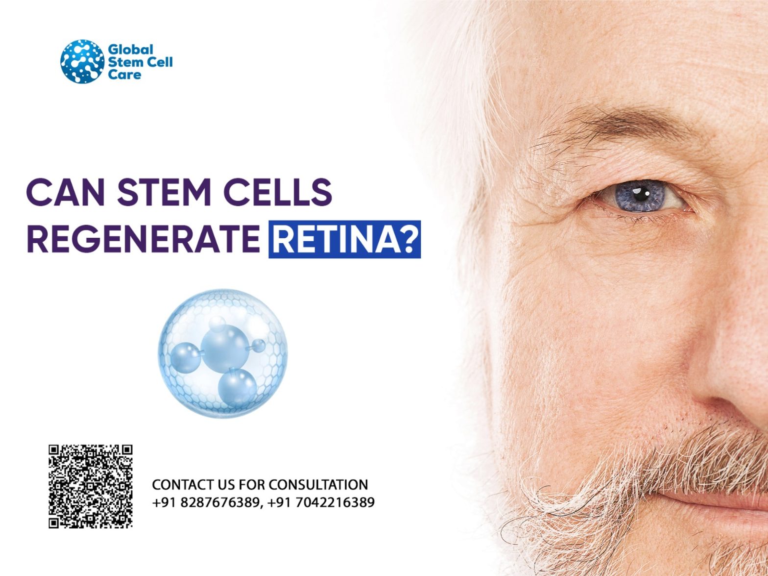 Can Stem Cells Regenerate Retina?