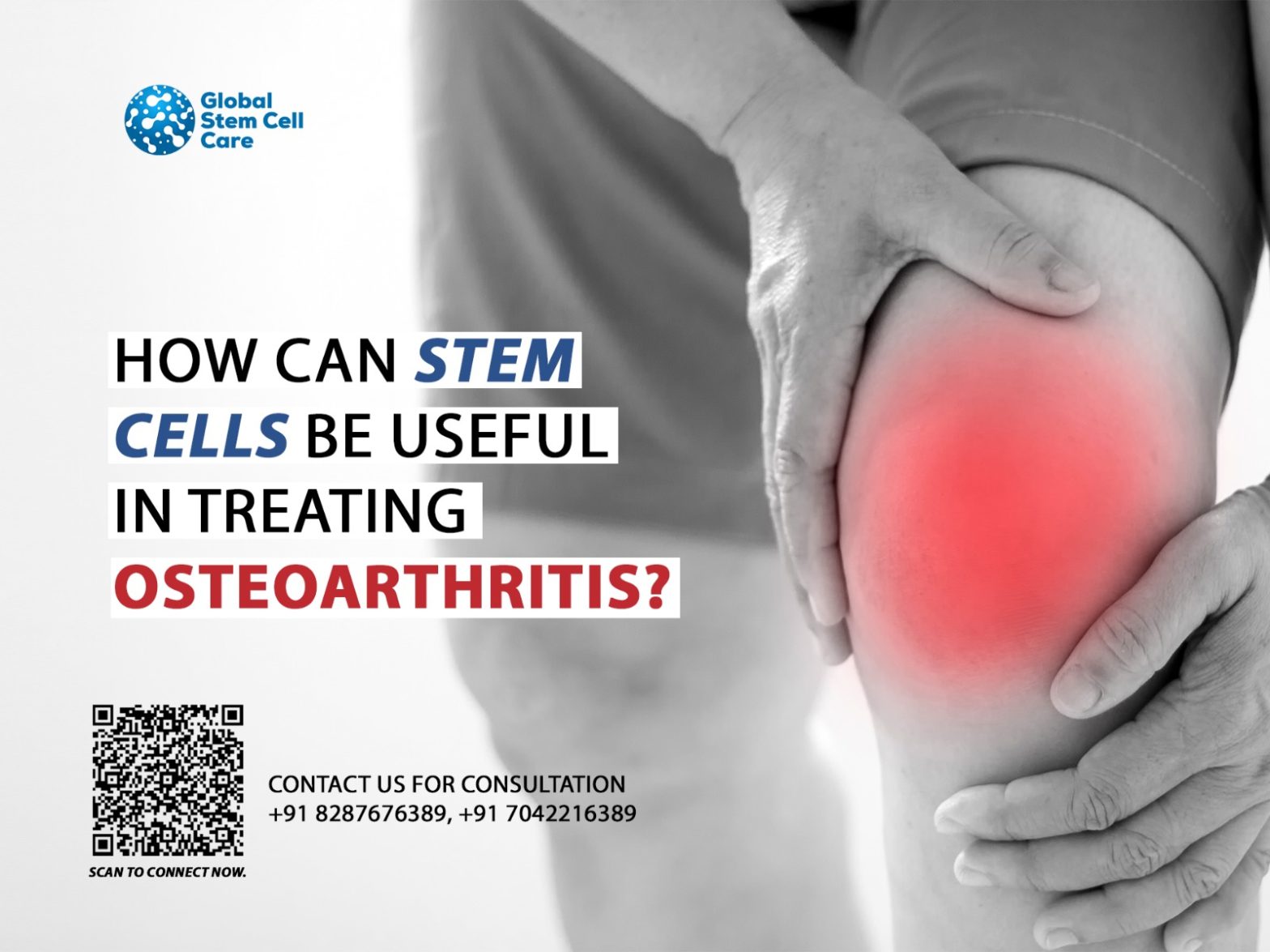 How Can Stem Cells Be Useful in Treating Osteoarthritis?