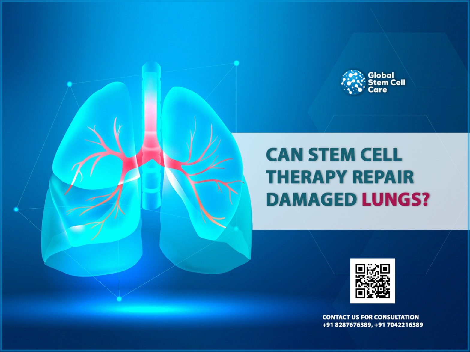 Can Stem Cell Therapy Repair Damaged Lungs?