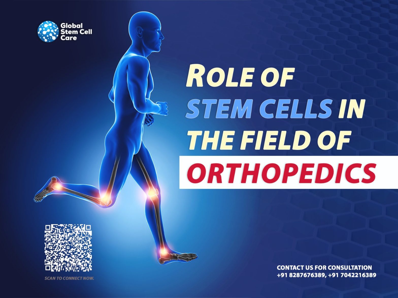 Role of Stem Cells in the Field of Orthopedics