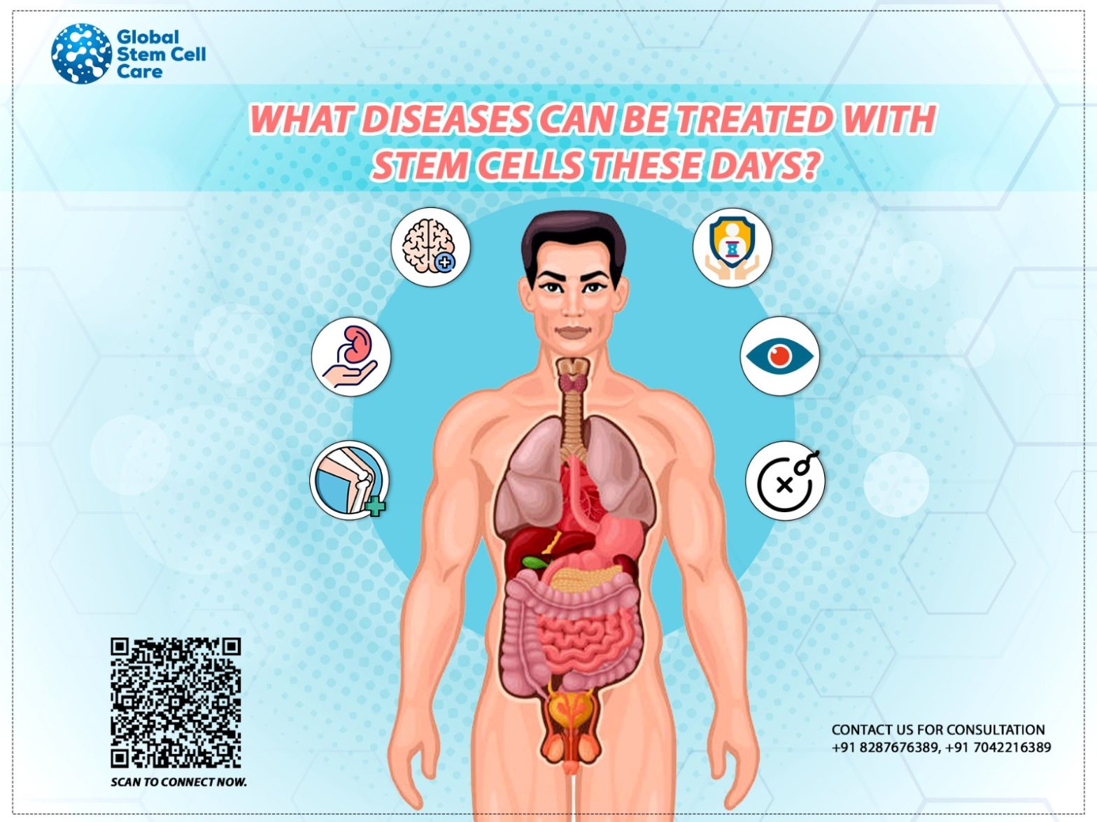 What Diseases Can Be Treated with Stem Cells These Days?