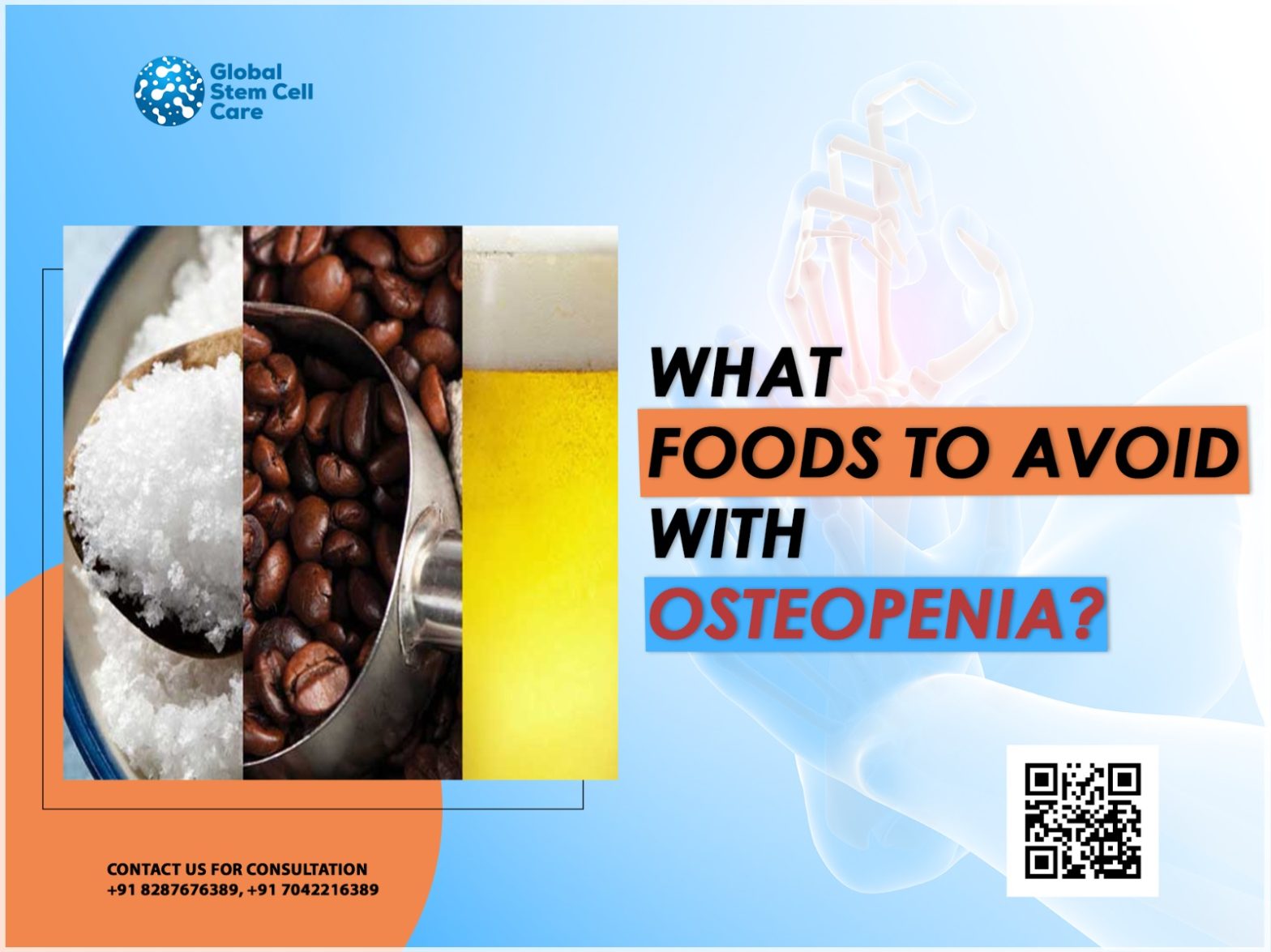 What Foods to Avoid With Osteopenia?