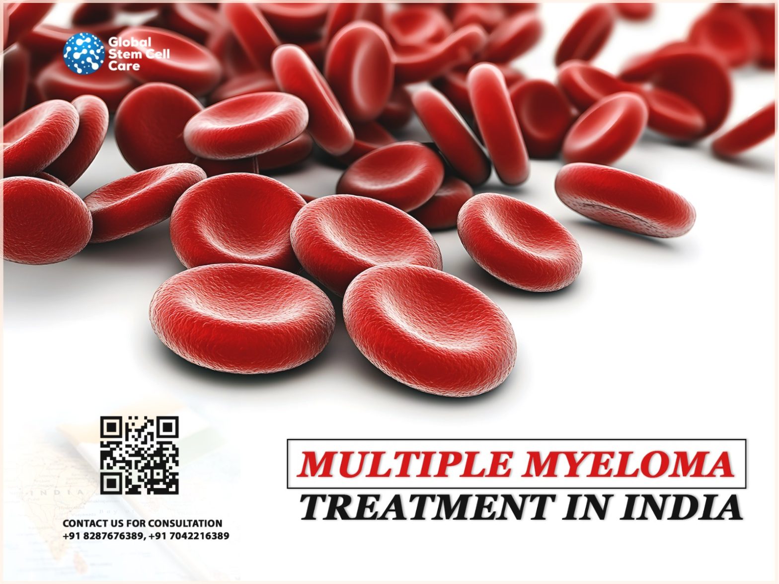 Multiple Myeloma Treatment in India
